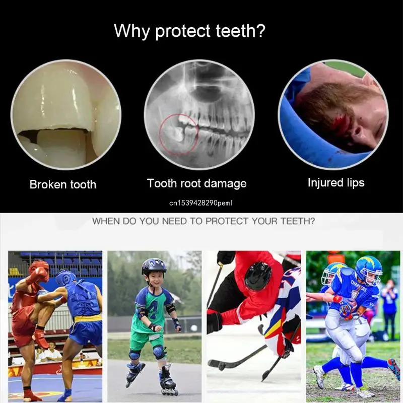 EVA Protetor de Boca | Dentes Protetor Protetor de Boca Bandejas para Bruxismo Moagem Anti-ronco Dentes Branqueamento de Boxe para Proteger Imagem 3